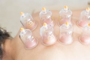 Cupping Massage Photo